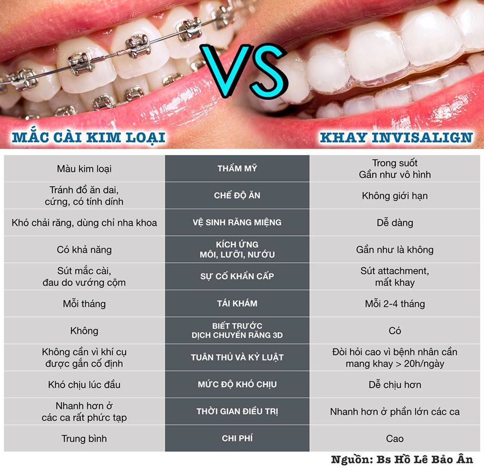 Invisalign và Mắc cài kim loại khác như thế nào