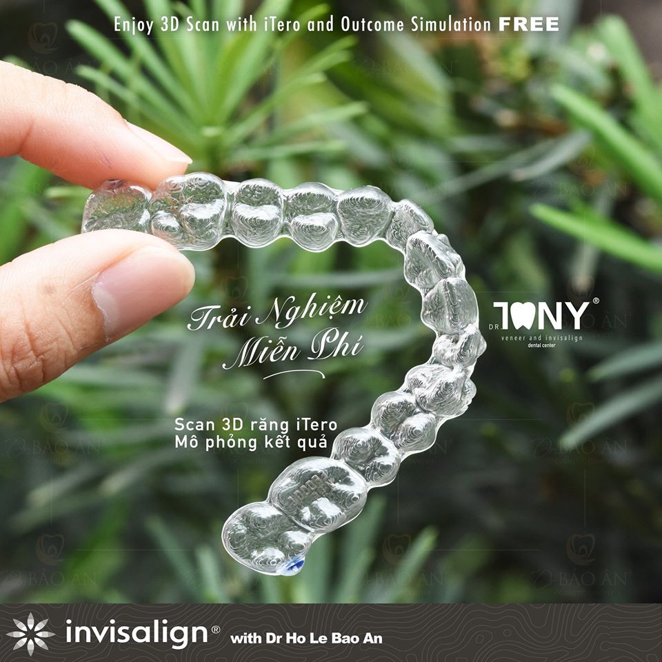 [Video] GẮN ATTACHMENT TRONG NIỀNG RĂNG TRONG SUỐT INVISALIGN